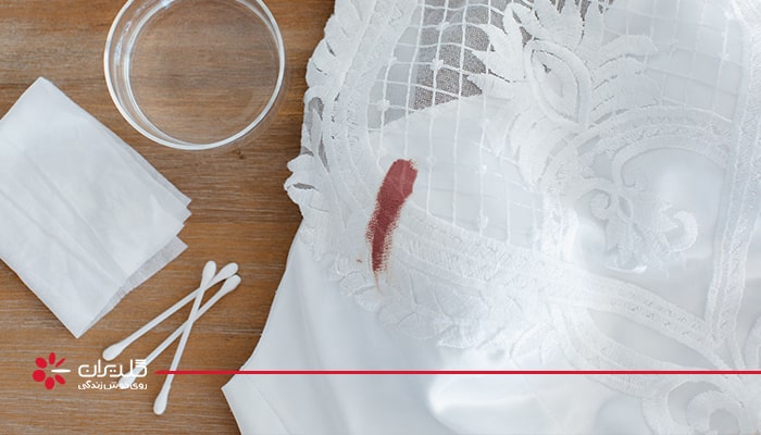پاک کردن لکه‌ها از روی لباس عروس